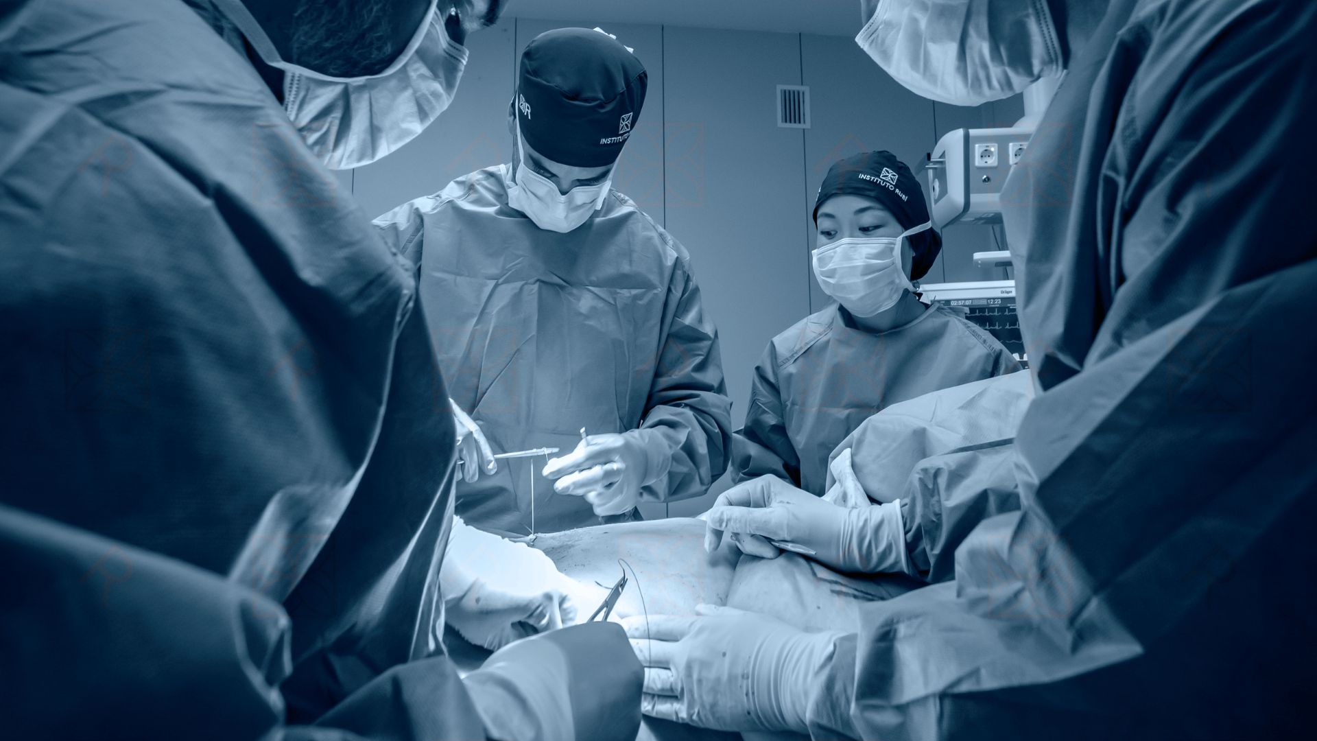 Tecnología de rinoplastia ultrasónica para nariz ancha o nariz recta
